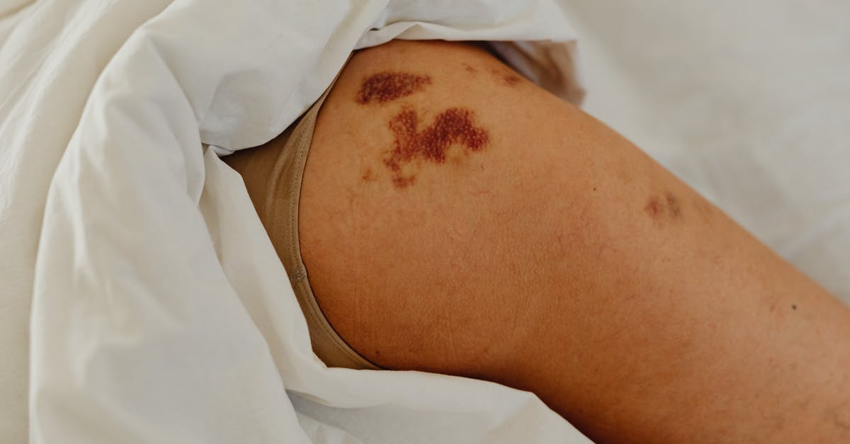 Enemy Tick marks on compass - Free stock photo of bed, blood, cure