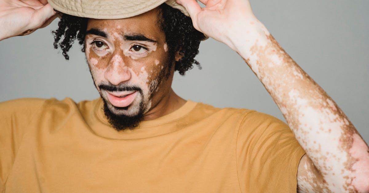 Skin overlay doesn't appear on servers - Young male in yellow T shirt with beard and vitiligo wearing hat and looking away on white background of studio