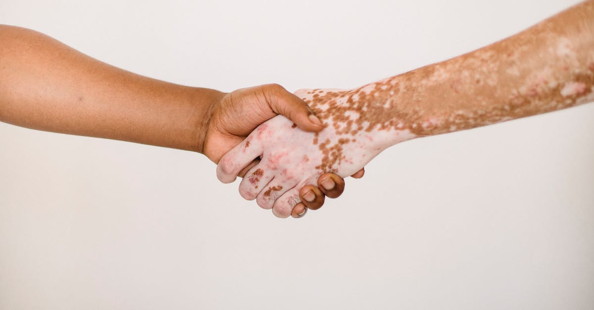 Why can't I join my friend on Minecraft Bedrock Edition? - Crop anonymous man shaking hand of male friend with vitiligo skin against white background